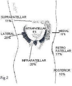 patello-femoral-pain-sindrome-a-raschi-2014